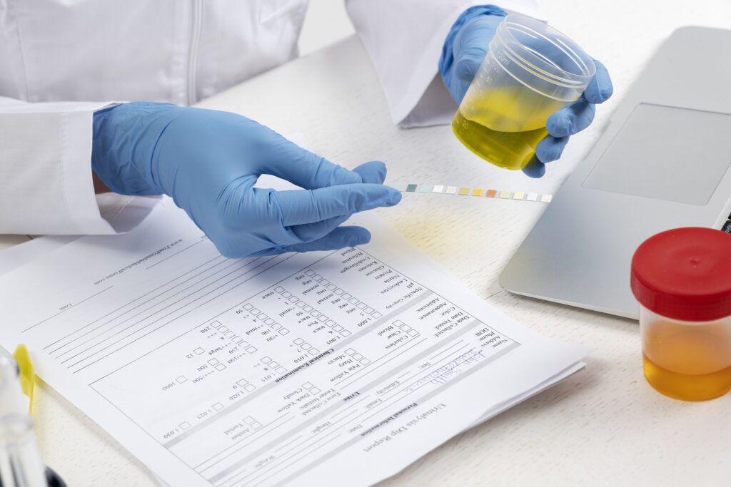Leukocytes in urine